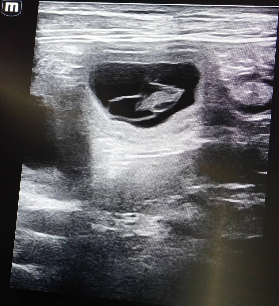 Ultralydsscanning af en af Blackys hvalpe